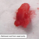 Elderly dog with Stage 4 Periodontal Disease and Tooth Root in Nasal Cavity North Coast Veterinary Specialist